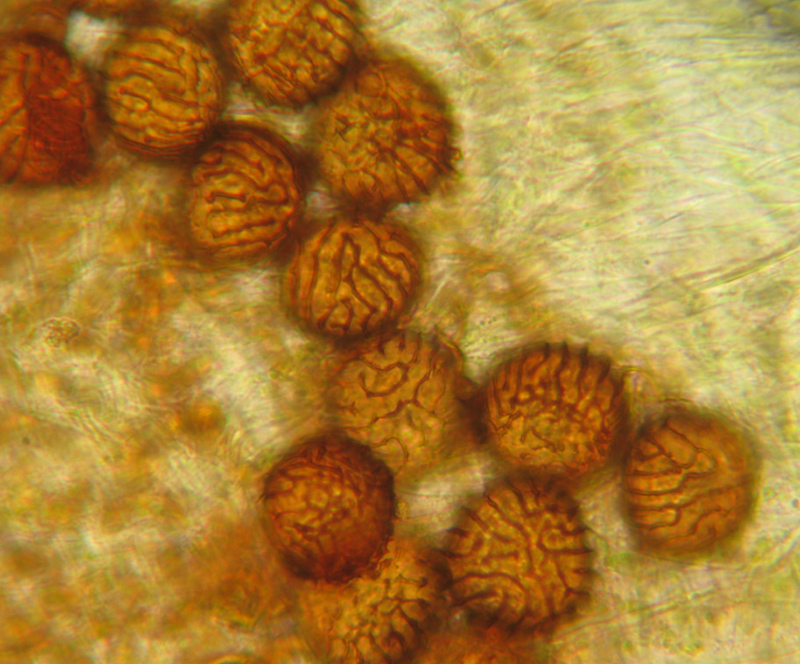 Fossombronia wondraczekii